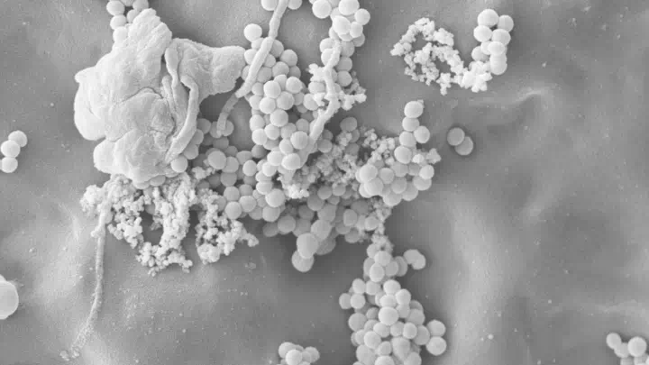 Bacteria repellent fabrics 720 405px